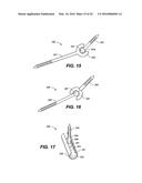 DEVICE AND METHOD FOR CORRECTING A SPINAL DEFORMITY diagram and image