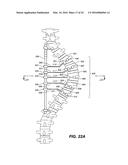 DEVICE AND METHOD FOR CORRECTING A SPINAL DEFORMITY diagram and image