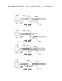 DEVICE AND METHOD FOR CORRECTING A SPINAL DEFORMITY diagram and image