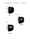 HEAT-DISTRIBUTION INDICATORS, THERMAL ZONE INDICATORS, ELECTROSURGICAL     SYSTEMS INCLUDING SAME, AND METHODS OF DIRECTING ENERGY TO TISSUE USING     SAME diagram and image