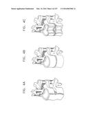 Method and Apparatus for Computerized Surgery diagram and image