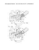 Method and Apparatus for Computerized Surgery diagram and image