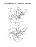 Method and Apparatus for Computerized Surgery diagram and image