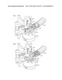 Method and Apparatus for Computerized Surgery diagram and image