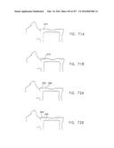 Method and Apparatus for Computerized Surgery diagram and image