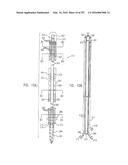 Method and Apparatus for Computerized Surgery diagram and image