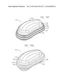 Method and Apparatus for Computerized Surgery diagram and image