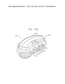 Method and Apparatus for Computerized Surgery diagram and image