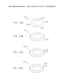 Method and Apparatus for Computerized Surgery diagram and image