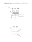 Method and Apparatus for Computerized Surgery diagram and image