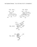 Method and Apparatus for Computerized Surgery diagram and image