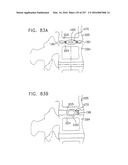 Method and Apparatus for Computerized Surgery diagram and image