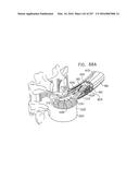 Method and Apparatus for Computerized Surgery diagram and image