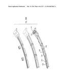 Method and Apparatus for Computerized Surgery diagram and image