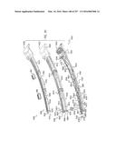 Method and Apparatus for Computerized Surgery diagram and image