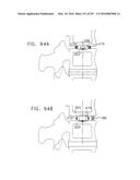 Method and Apparatus for Computerized Surgery diagram and image