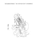 Method and Apparatus for Computerized Surgery diagram and image