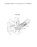 Method and Apparatus for Computerized Surgery diagram and image