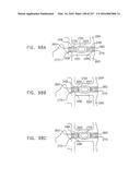 Method and Apparatus for Computerized Surgery diagram and image