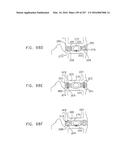 Method and Apparatus for Computerized Surgery diagram and image