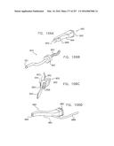 Method and Apparatus for Computerized Surgery diagram and image