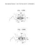 Method and Apparatus for Computerized Surgery diagram and image