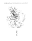 Method and Apparatus for Computerized Surgery diagram and image