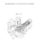 Method and Apparatus for Computerized Surgery diagram and image