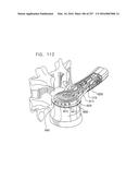 Method and Apparatus for Computerized Surgery diagram and image