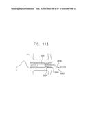 Method and Apparatus for Computerized Surgery diagram and image