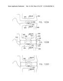 Method and Apparatus for Computerized Surgery diagram and image