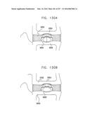 Method and Apparatus for Computerized Surgery diagram and image