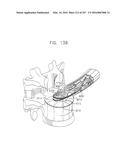 Method and Apparatus for Computerized Surgery diagram and image