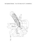 Method and Apparatus for Computerized Surgery diagram and image