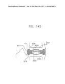 Method and Apparatus for Computerized Surgery diagram and image