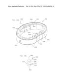 Method and Apparatus for Computerized Surgery diagram and image