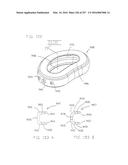 Method and Apparatus for Computerized Surgery diagram and image