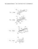 Method and Apparatus for Computerized Surgery diagram and image