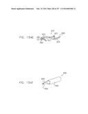 Method and Apparatus for Computerized Surgery diagram and image