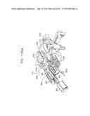 Method and Apparatus for Computerized Surgery diagram and image