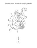 Method and Apparatus for Computerized Surgery diagram and image