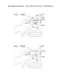 Method and Apparatus for Computerized Surgery diagram and image