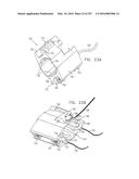 Method and Apparatus for Computerized Surgery diagram and image