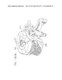 Method and Apparatus for Computerized Surgery diagram and image