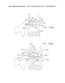 Method and Apparatus for Computerized Surgery diagram and image