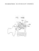 Method and Apparatus for Computerized Surgery diagram and image