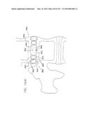 Method and Apparatus for Computerized Surgery diagram and image