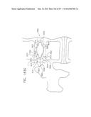 Method and Apparatus for Computerized Surgery diagram and image