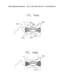 Method and Apparatus for Computerized Surgery diagram and image