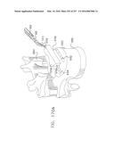 Method and Apparatus for Computerized Surgery diagram and image